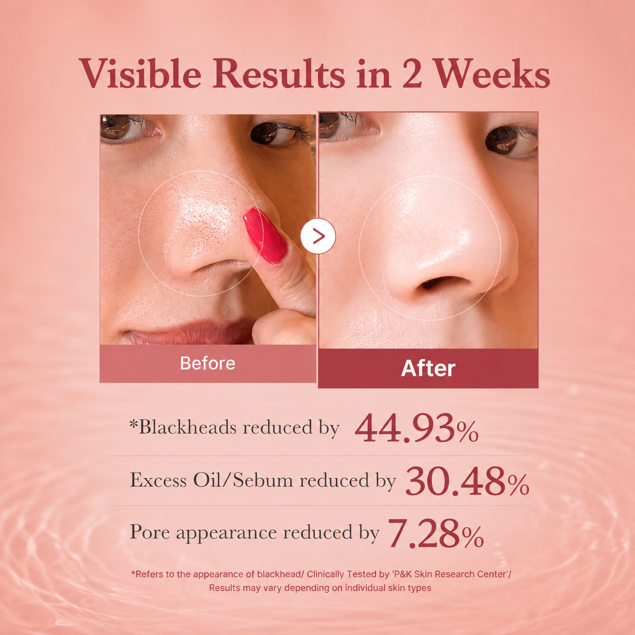 Velyra™ Pore Eliminator Pads